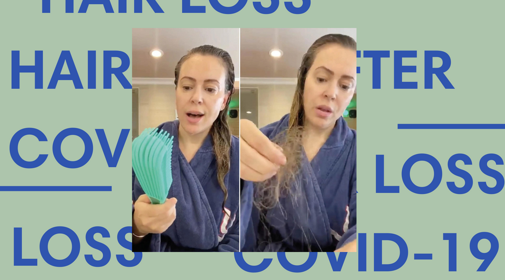 Hair loss after COVID-19